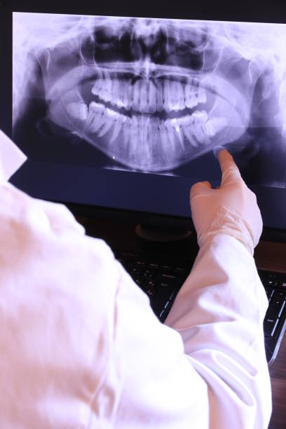 Best Emergency Root Canal Treatment in Byrdstown, TN