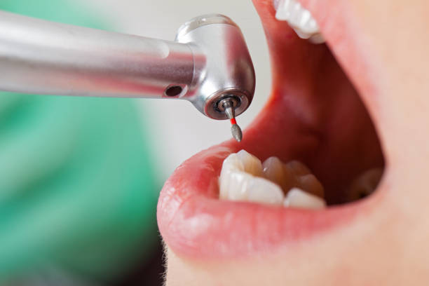 Best Emergency Dentist for Knocked-Out Tooth in Byrdstown, TN